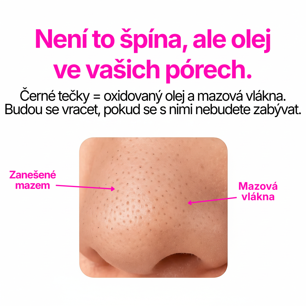 Skinsense™ Vakuový čistič pórů