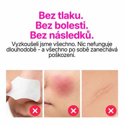 Skinsense™ Vakuový čistič pórů