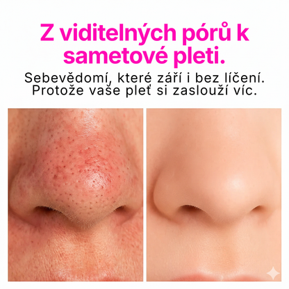 Skinsense™ Vakuový čistič pórů